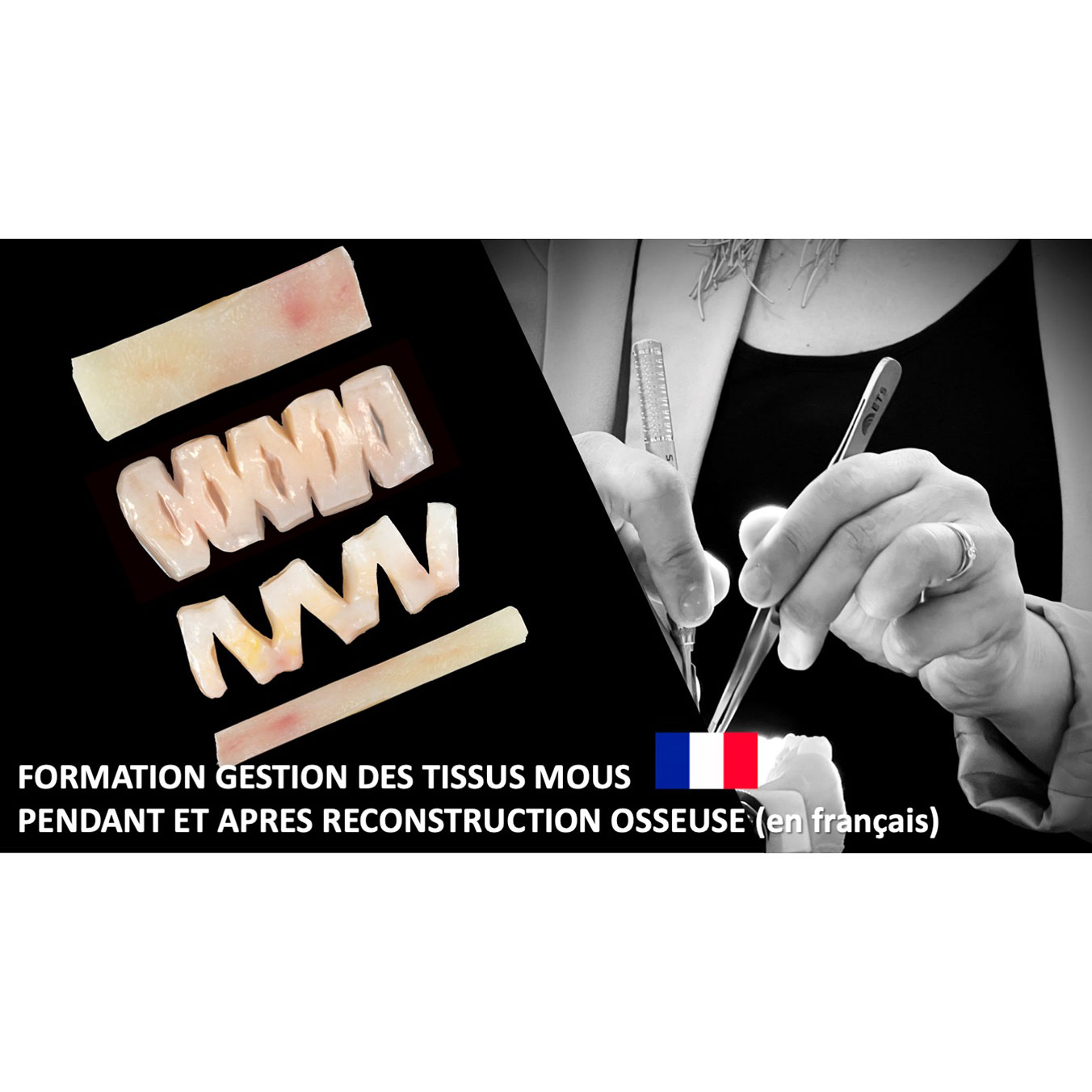 Formation Gestion des tissus mous pendant & après augmentation osseuse - 2 & 3 novembre 2026